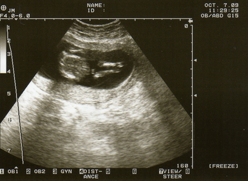 ultrasound 1